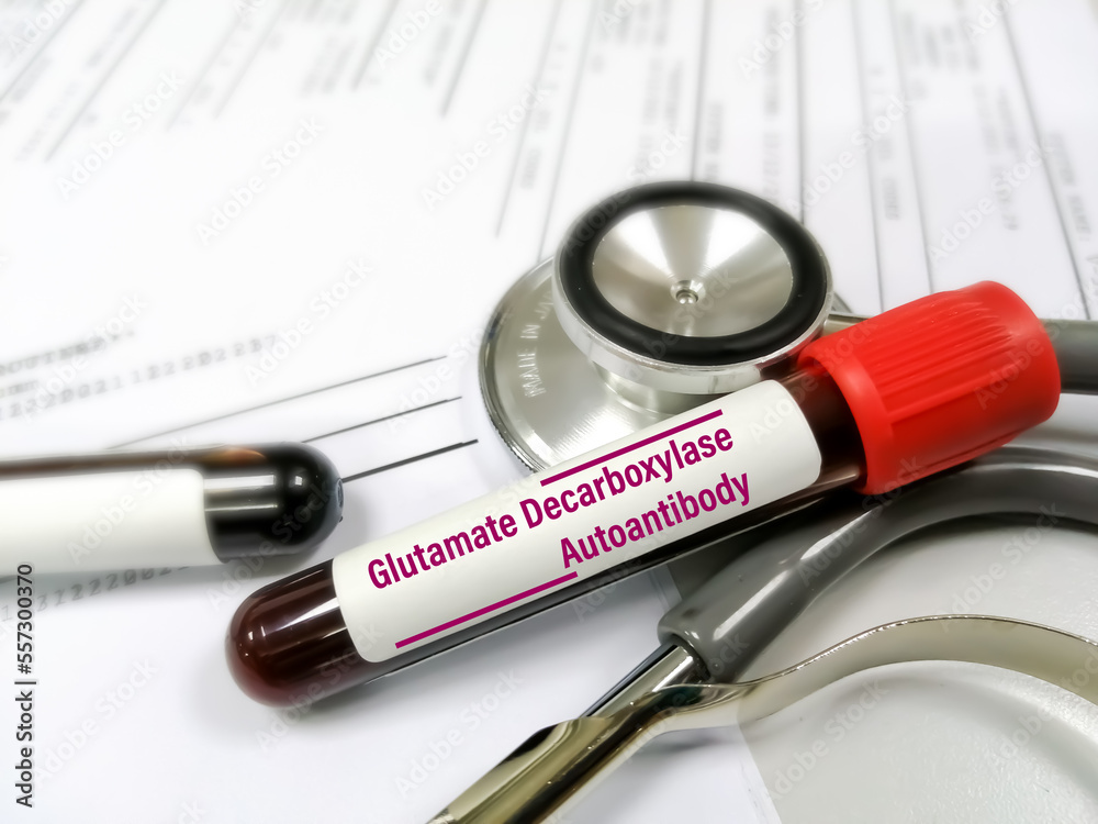 Blood sample for Glutamic acid decarboxylase antibody (GADA) test