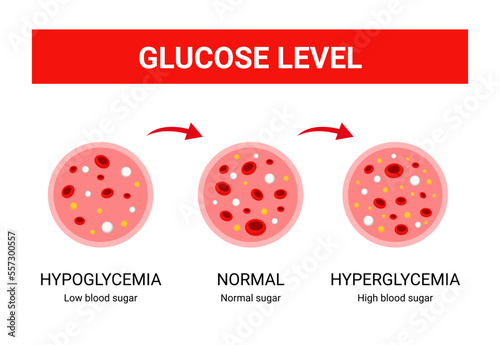 Glucose blood infographics, glucose level 