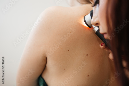 Close-up of woman dermatologist making examination using dermatoscope. Consultation with doctor. Experienced dermatologist checking moles on skin of young woman