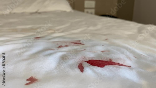 Close up menstruation blood stain on white bed sheet inside hotel room. Woman period hygiene concept 4k video.