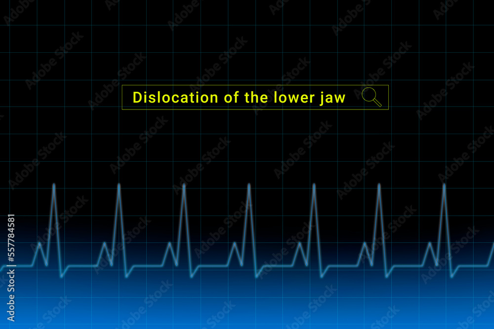 Dislocation of the lower jaw.Dislocation of the lower jaw inscription in search bar. Illustration with titled Dislocation of the lower jaw . Heartbeat line as a symbol of human disease. Dislocation of the lower jaw.Dislocation of the lower jaw inscription in search bar. Illustration with titled Dislocation of the lower jaw . Heartbeat line as a symbol of human disease.