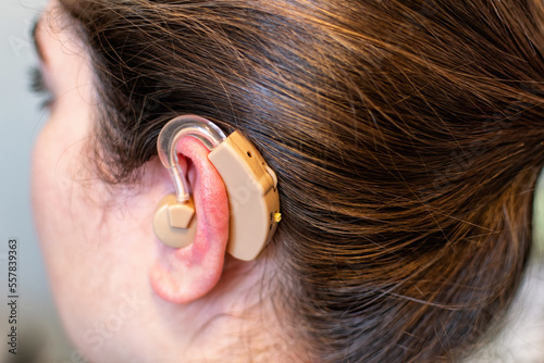 Картината върху платно Young woman wearing a hearing aid. World hearing day concept.