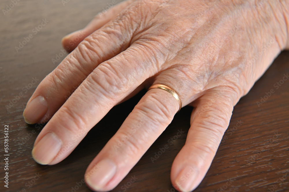 Fototapeta premium しわが目立つ指輪をはめたシニア女性の手