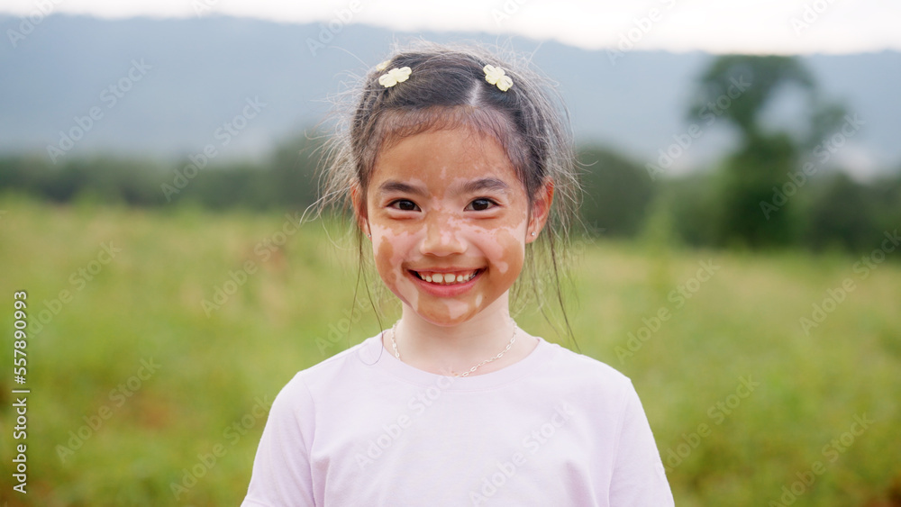 Little cute alpha young albino vitiligo small school girl relax smile look at camera. Real melanin face body skin care hair color of asia people gen z kid in self love happy proud of diverse beauty. - obrazy, fototapety, plakaty 