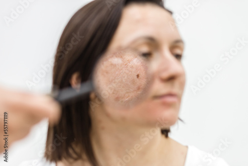 Close up photo of woman with dry skin with magnifying glass.