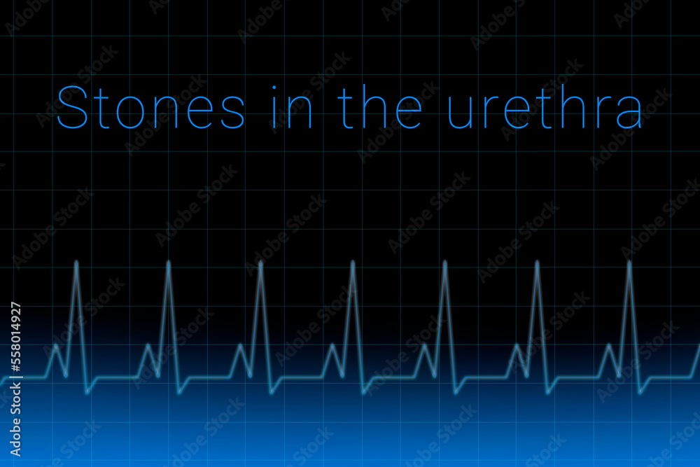 Stones in the urethra disease. Stones in the urethra logo on a dark background. Heartbeat line as a symbol of human disease. Concept Medication for disease Stones in the urethra. Stones in the urethra disease. Stones in the urethra logo on a dark background. Heartbeat line as a symbol of human disease. Concept Medication for disease Stones in the urethra.