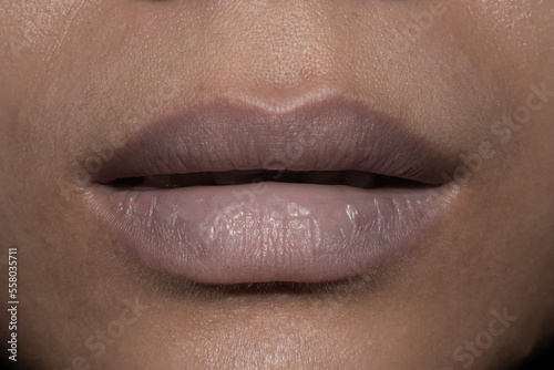 Pale lips of Asian sick woman. Sign of anaemia. 