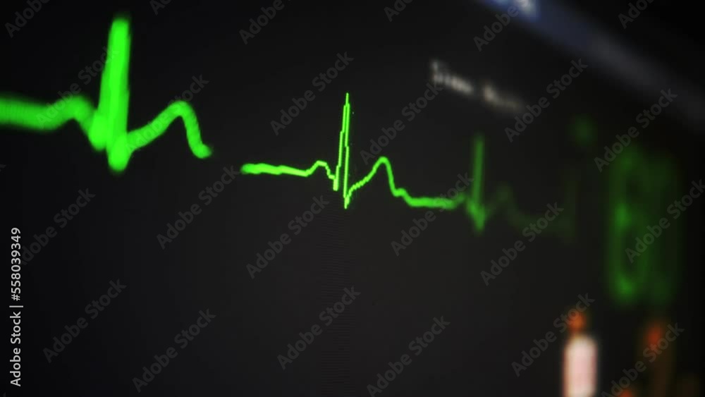 flatline ekg heart monitoring motion design vfx emergency hospital