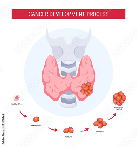 Thyroid cancer development process