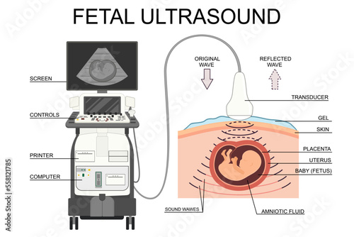 Fetal ultrasound illustration. Medical poster. Pregnancy ultrasound picture. Baby in the womb. Little embryo silhouette. Pregnant woman clinic examination. Vector human embryo.