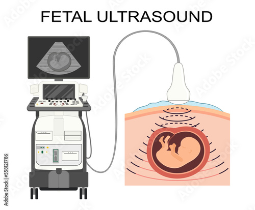 Fetal ultrasound illustration. Medical poster. Pregnancy ultrasound picture. Baby in the womb. Little embryo silhouette. Pregnant woman clinic examination. Vector human embryo.