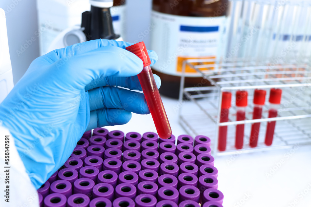 blood sample to analyze in the laboratory