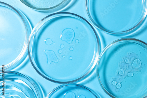 Petri dishes with liquids on light blue background, flat lay