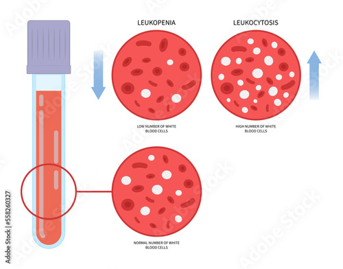 venipuncture collection low and high white blood Cell count for thrombocytosis of Basophilia basophils