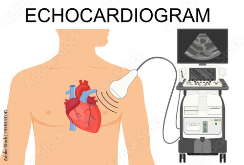 Echocardiogram. Heart ultrasound.  Medical Vector illustration of Echocardiogram for articles, posters, banners.  Cardiology Echo test. Diagnose cardiac problem. Preventing, diagnosing a heart attack.