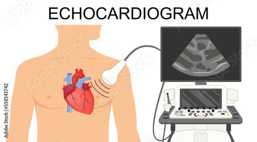 Echocardiogram. Heart ultrasound.  Medical Vector illustration of Echocardiogram for articles, posters, banners.  Cardiology Echo test. Diagnose cardiac problem. Preventing, diagnosing a heart attack.
