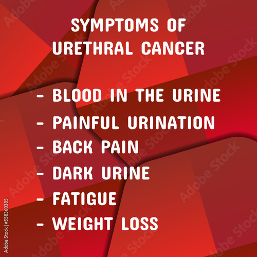 Symptoms of urethral cancer.  Vector illustration for medical journal or brochure. 