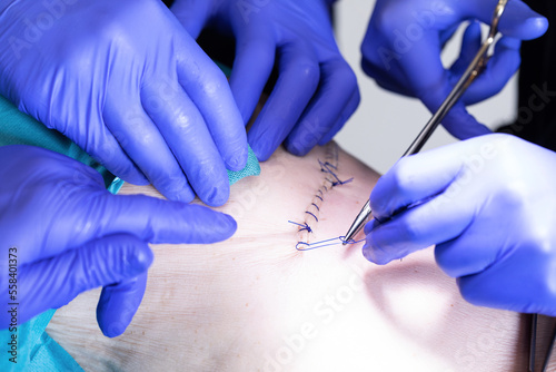 Surgery
