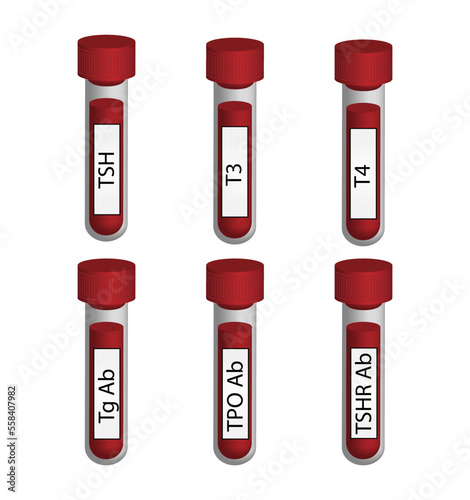 Thyroid test, Thyroid gland. TSH, T3, T4 hormones. Thyroglobulin, Thyroid peroxidase and Thyroid stimulating hormone receptor antibodies. Hypothyroidism and hyperthyroidism. Vector illustration.