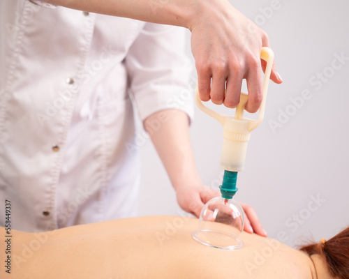 Female massage therapist uses vacuum cans on the patient's back. 