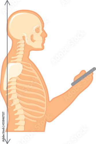 Human posture with straight neck and phone in hands
