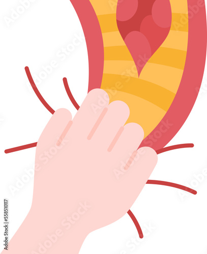atherosclerosis  icon