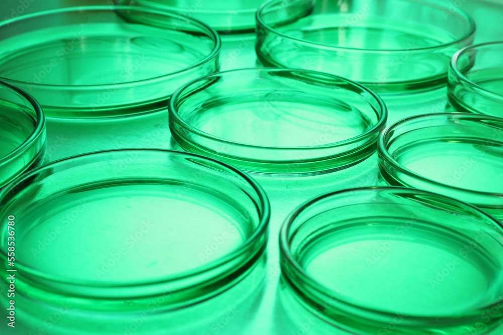 Petri dishes with samples on table, toned in green Petri dishes with samples on table, toned in green