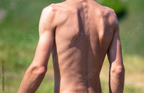 Bare back of a man.