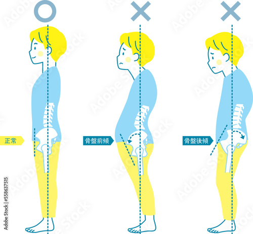 男性の良い姿勢と悪い姿勢の見本_骨盤