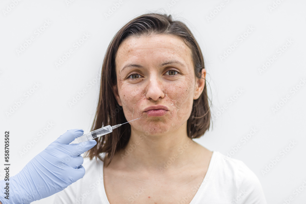 Close up photo of woman with dry skin and hand in medical glove with injection. Close up photo of woman with dry skin and hand in medical glove with injection.