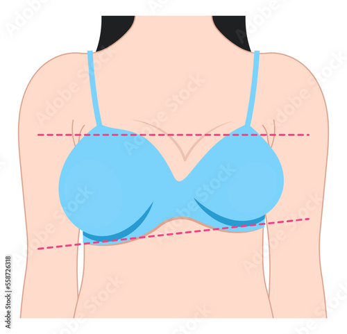 Breast Lift Fat Transfer large mass size small shape one bigger than pain examine density milk gland duct test Lump malignant cyst woman Implant sagging