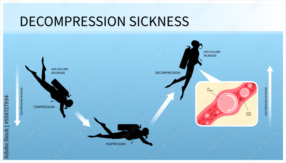 Diver loss of appetite and Henry's carbon law the lung air oxygen gas