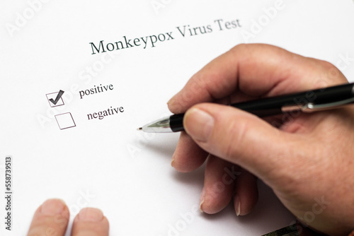 Results of monkeypox virus test on white paper