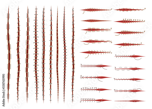 Set of surgical sutures. First aid injury stitch, medical stitches scars and wounds cartoon vector illustration