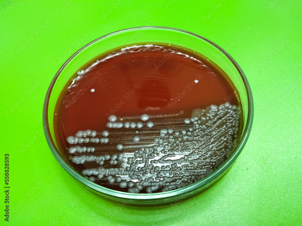 Hemolysis. Bacterial colonies to induce hemolysis when grown on blood
