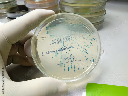 HiChrome or UTI agar medium plate showing pure growth of Enterococcus bacteria photo