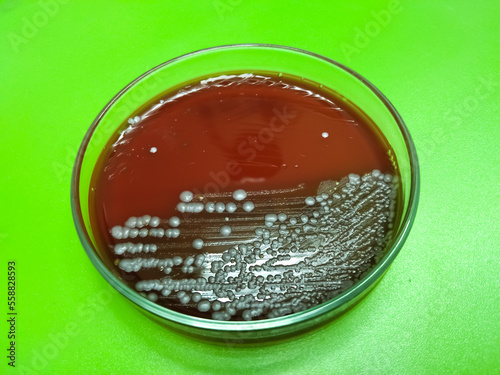 Hemolysis. Bacterial colonies to induce hemolysis when grown on blood agar, streptococcal species bacteria photo