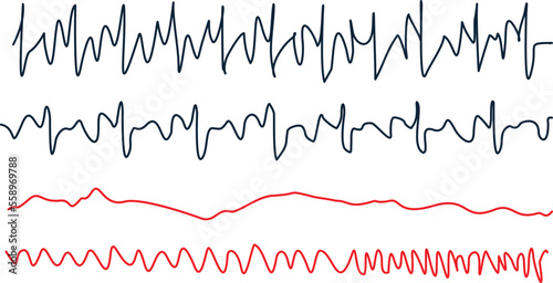 Ekg heart rate monitor. Healthcare concept using technology.