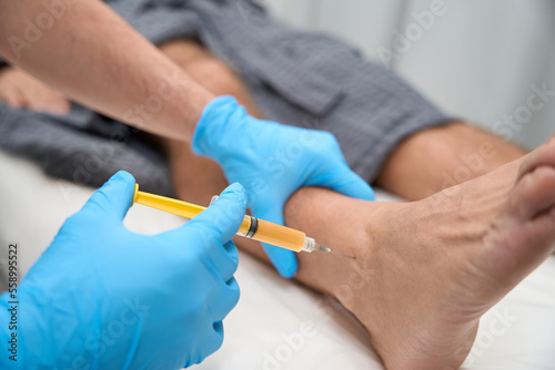 Qualified medical specialist performing a biopsy sampling from ankle Fototapet