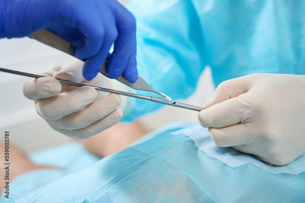 Medicine pellet insertion procedure, medical staff use a special tool Medicine pellet insertion procedure, medical staff use a special tool