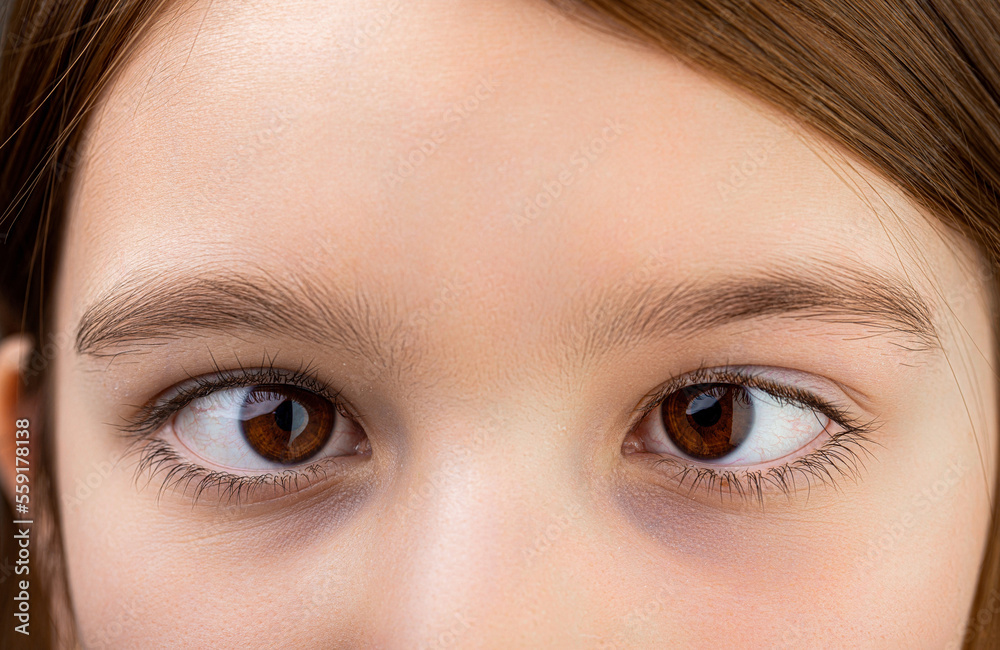 Strabismus. Close-up part child's face, eyes girl. Little patient strabismus, treatment ophthalmic diseases. Strabismus in children causes, treatment concept. Female eyes with strabismus. Hypertropia Strabismus. Close-up part child's face, eyes girl. Little patient strabismus, treatment ophthalmic diseases. Strabismus in children causes, treatment concept. Female eyes with strabismus. Hypertropia