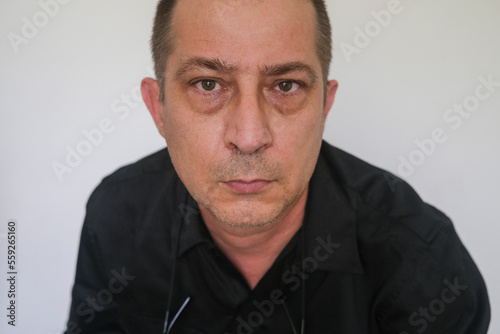 Closeup portrait of caucasian man with baggy eyes looking at the camera, against white background