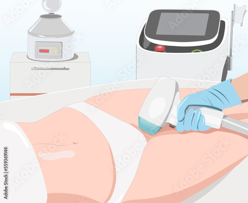 Illustration.Elos epilation, hair removal procedure on a woman’s body. Beautician doing laser rejuvenation in a beauty salon. Removing unwanted body hair.	