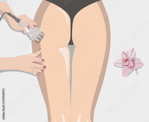 illustration. The cosmetologist does the Rf lifting procedure on the legs, buttocks and hips of a woman in a beauty parlor. Treatment of overweight and flabby skin.	