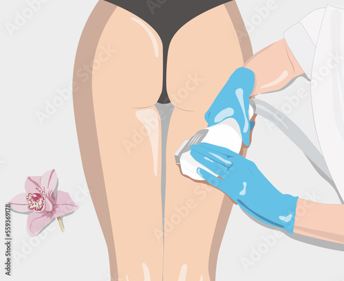 Illustration.Elos epilation, hair removal procedure on a woman’s body. Beautician doing laser rejuvenation in a beauty salon. Removing unwanted body hair.	