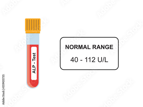 ALP (Alkaline Phosphatase) Blood Test Concept Design. Vector Illustration.
