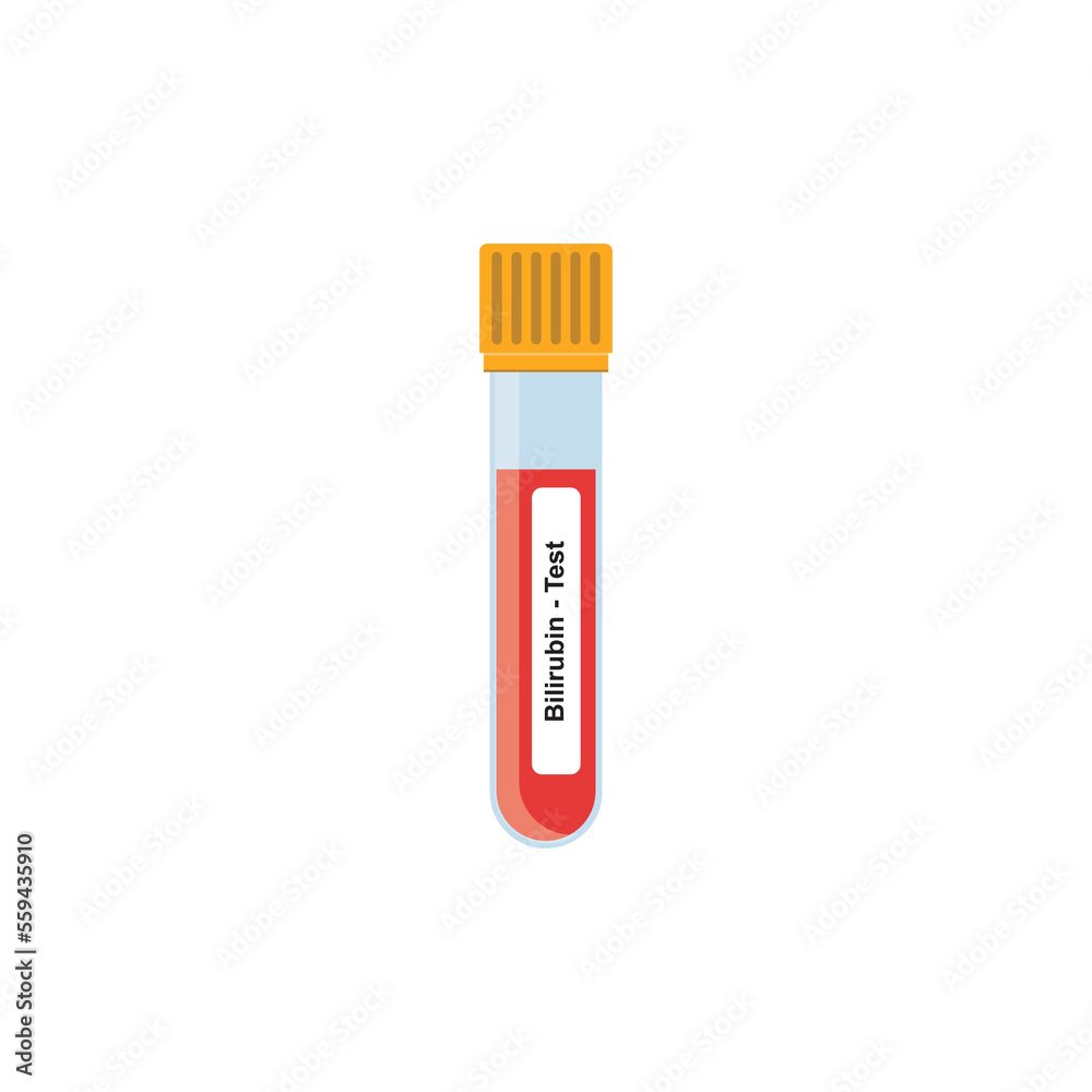 Bilirubin Blood Test Concept Design. Vector Illustration. Bilirubin Blood Test Concept Design. Vector Illustration.