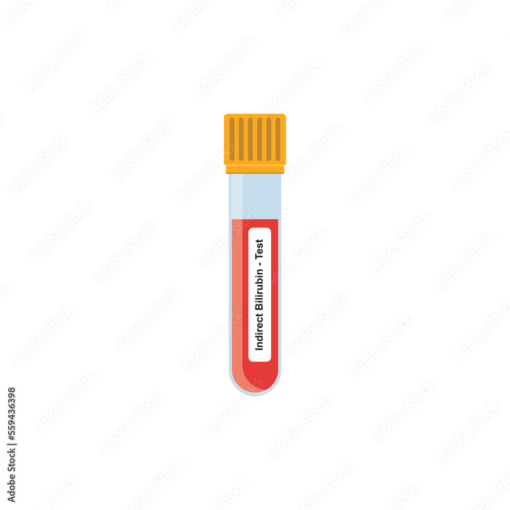 Indirect Bilirubin Blood Test Concept Design. Vector Illustration. Indirect Bilirubin Blood Test Concept Design. Vector Illustration.