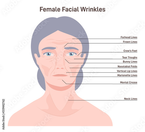 Mimic wrinkles. Age-related skin changes. Aging process, forehead