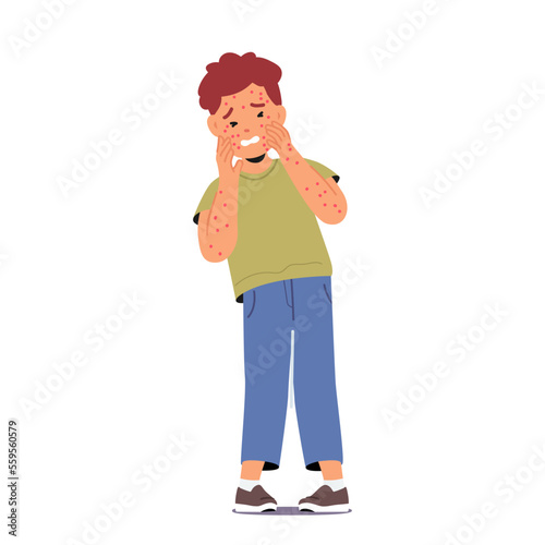 Child with Food Allergy Symptoms Red Itchy Spots on Body and Face Isolated on White Background. Little Boy Allergic